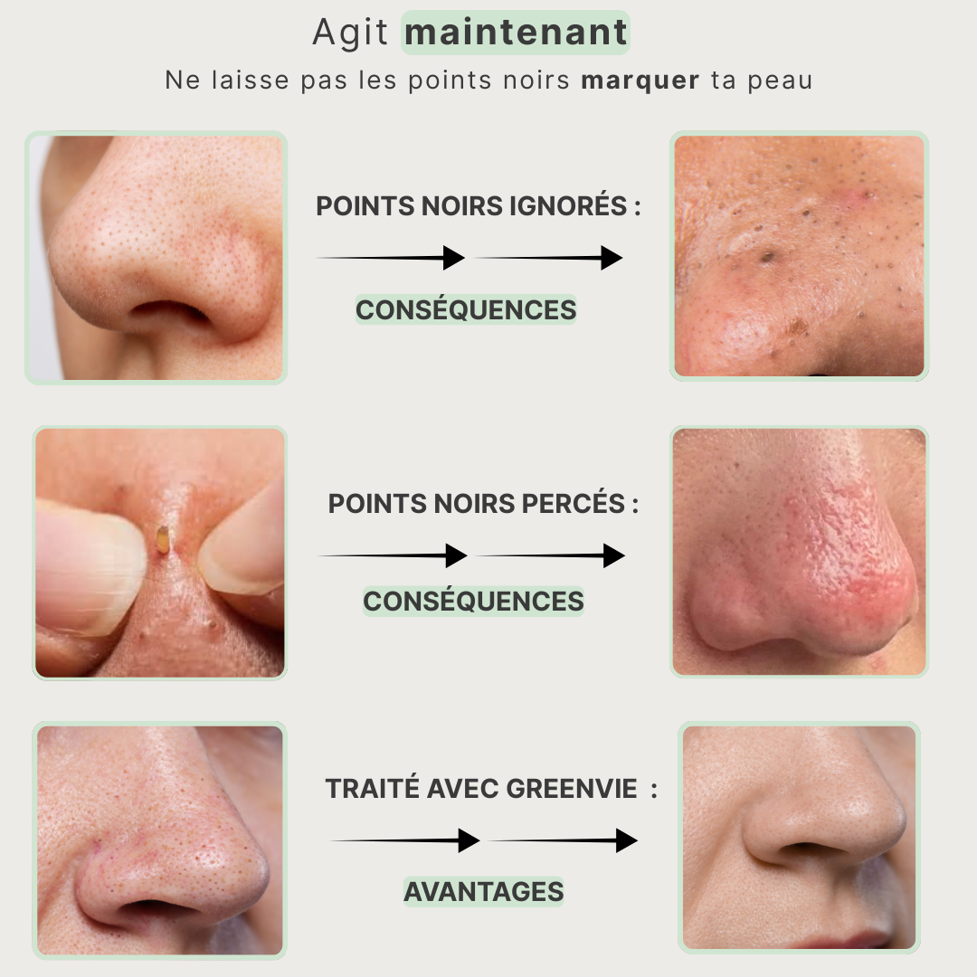 Masque Purifiant et Anti-Bactérien au Thé Vert pour une peau éclatante, purifiée et hydratée