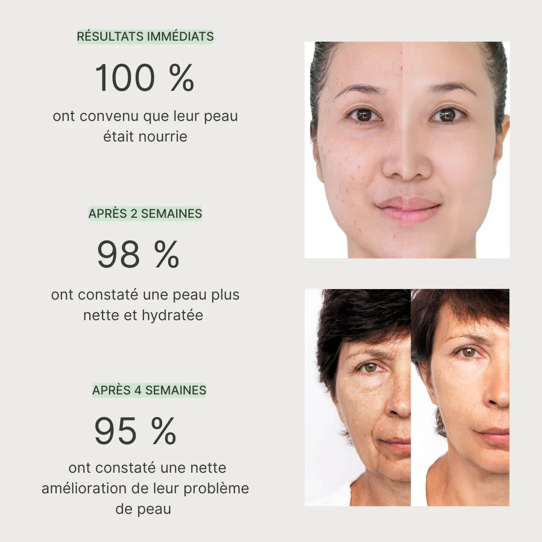 Masque Purifiant et Anti-Bactérien au Thé Vert pour une peau éclatante, purifiée et hydratée