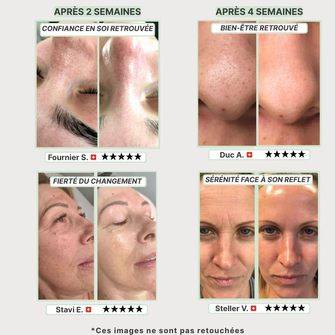 Masque Purifiant et Anti-Bactérien au Thé Vert pour une peau éclatante, purifiée et hydratée